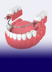 The James Clinic Acrylic Dentures Treatment Image