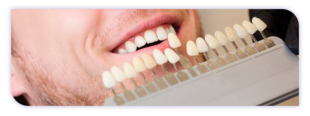 The James Clinic Blog Post Header A Beginners Guide to Cosmetic Dentistry in Ireland