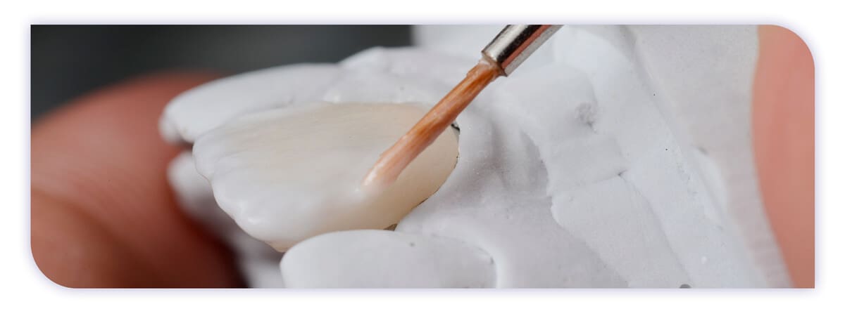 The James Clinic Blog Post Header Dental Composite Explained