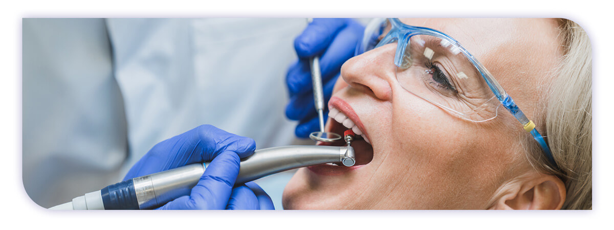 The James Clinic Blog Post Header Image getting to the root of dental fillings and how long they last