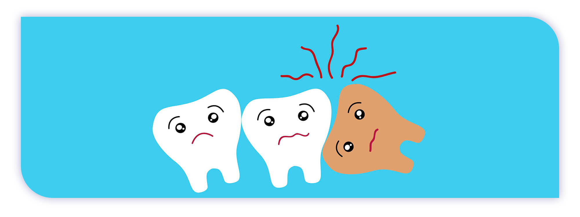 The James Clinic Blog Post Header Image what is an impacted wisdom tooth how do you know if you have one