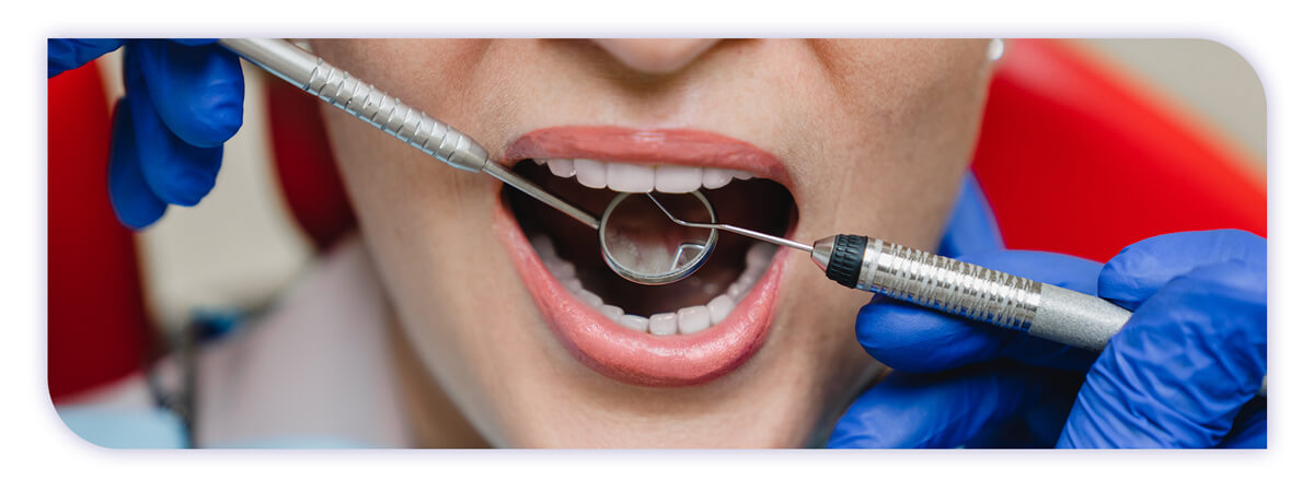 The James Clinic Blog Post Header Image what to expect with the dental crown procedure