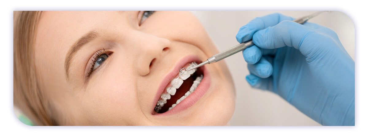 The James Clinic Blog Post Header Image why should you need to get dental braces
