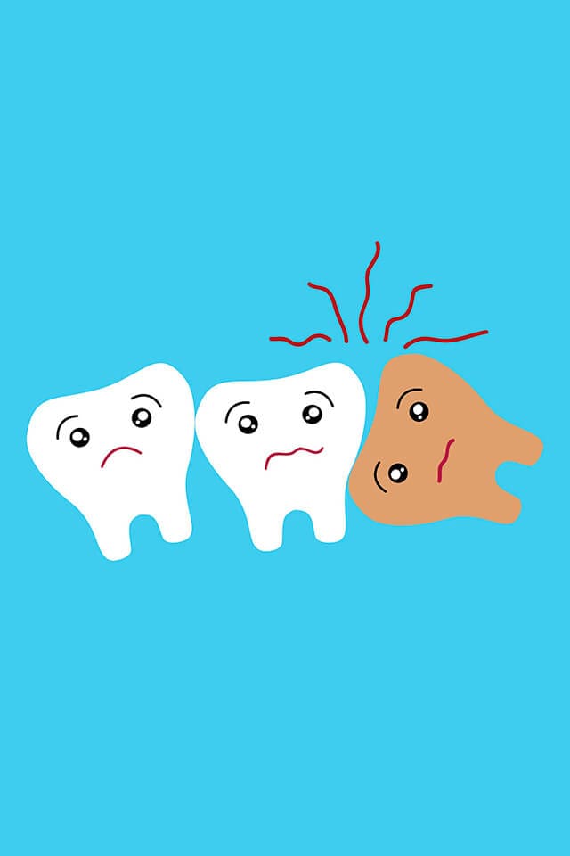 What Is An Impacted Wisdom Tooth And How Do You Know If You Have One? - The James Clinic What Is An Impacted Wisdom Tooth And How Do You Know If You Have One? - The James Clinic