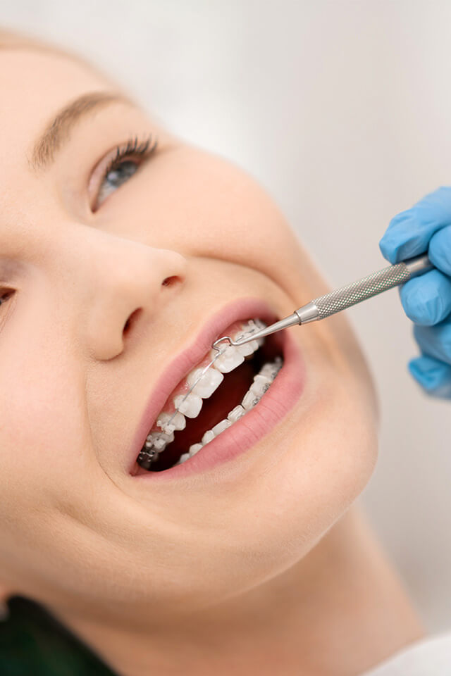 The James Clinic Blog Post Thumbnail why should you need to get dental braces